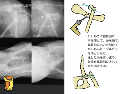 股関節脱臼