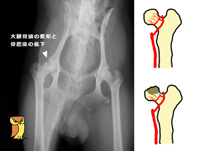 レッグペルテス病 